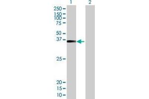 Lane 1: ZNF514 transfected lysate ( 44.
