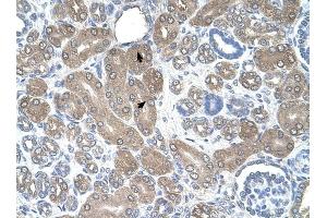 ST3GAL5 antibody was used for immunohistochemistry at a concentration of 4-8 ug/ml to stain Epithelial cells of renal tubule (arrows) in Human Kidney.