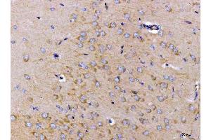 IHC analysis of ch TOG/CKAP5 using anti-ch TOG/CKAP5 antibody (ABIN6719294).