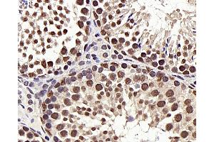Immunohistochemistry analysis of paraffin-embedded mouse testis using HDAC1 Polyclonal Antibody at dilution of 1:300. (HDAC1 抗体)