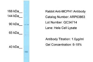 Western Blotting (WB) image for anti-Microcephalin 1 (MCPH1) (C-Term) antibody (ABIN2789647) (MCPH1 抗体  (C-Term))