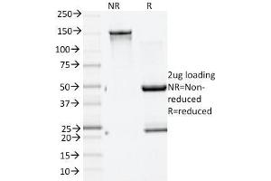 SDS-PAGE Analysis Purified GAD2 (GAD65) Mouse Monoclonal Antibody (GAD2/1960). (GAD65 抗体  (AA 6-99))