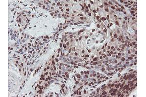 Image no. 3 for anti-Exosome Component 7 (EXOSC7) antibody (ABIN1498140)