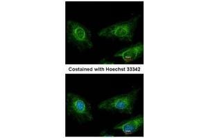 ICC/IF Image Immunofluorescence analysis of methanol-fixed HeLa, using Asporin, antibody at 1:200 dilution. (Asporin 抗体)