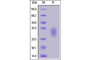 SDS-PAGE (SDS) image for Interleukin 22 (IL22) (AA 34-179) (Active) protein (His tag,AVI tag,Biotin) (ABIN6973118)