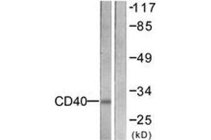 Western blot analysis of extracts from COS7 cells, using CD40 Antibody. (CD40 抗体  (AA 228-277))