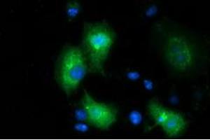Anti-MGRN1 mouse monoclonal antibody (ABIN2454424) immunofluorescent staining of COS7 cells transiently transfected by pCMV6-ENTRY MGRN1 (RC208284). (Mahogunin RING Finger Protein 1 抗体)