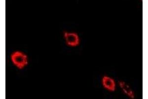 Immunofluorescent analysis of NEK3 staining in Hela cells. (NEK3 抗体)