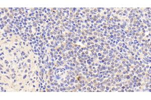 Detection of IL8Rb in Human Spleen Tissue using Polyclonal Antibody to Interleukin 8 Receptor Beta (IL8Rb) (CXCR2 抗体  (AA 1-57))