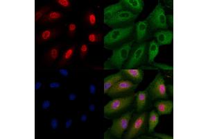 ABIN7093964 and ABIN7098008 staining  cells by IF/ICC. (PRUNE2 抗体  (N-Term))