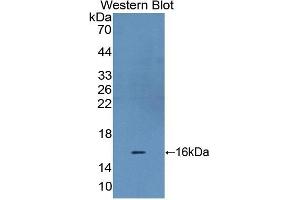 Detection of Recombinant HIF1a, Rat using Polyclonal Antibody to Hypoxia Inducible Factor 1 Alpha (HIF1a)