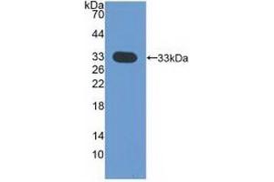Detection of Recombinant CDK4, Human using Polyclonal Antibody to Cyclin Dependent Kinase 4 (CDK4) (CDK4 抗体  (AA 6-295))