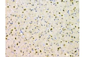 IHC analysis of SHP2/PTPN11 using anti SHP2/PTPN11 antibody (ABIN6719583).