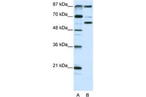 Western Blotting (WB) image for anti-K(lysine) Acetyltransferase 2B (KAT2B) antibody (ABIN2460477) (KAT2B 抗体)