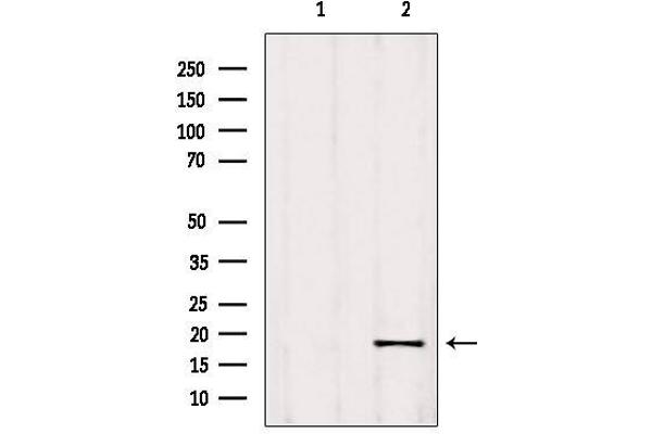 RPP25L 抗体  (C-Term)