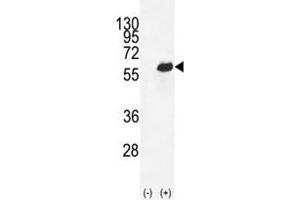 Western blot analysis of Osteopontin antibody and 293 cell lysate (2 ug/lane) either nontransfected (Lane 1) or transiently transfected (2) with the OPN-a/b gene. (Osteopontin 抗体  (AA 14-40))