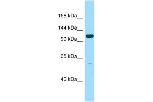 WB Suggested Anti-PPFIBP2 Antibody Titration: 1. (PPFIBP2 抗体  (C-Term))