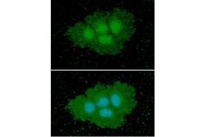 ICC/IF analysis of ASS1 in Hep3B cells line, stained with DAPI (Blue) for nucleus staining and monoclonal anti-human ASS1 antibody (1:100) with goat anti-mouse IgG-Alexa fluor 488 conjugate (Green). (ASS1 抗体  (AA 1-412))