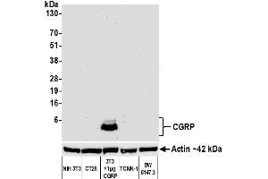 Western Blotting (WB) image for anti-Calcitonin-Related Polypeptide alpha (CALCA) antibody (ABIN7449372) (Recombinant CGRP 抗体)