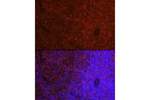 Immunofluorescence analysis of rat spleen cells using ASC/TMS1 Rabbit pAb (ABIN3021616, ABIN3021617, ABIN3021618, ABIN1513454 and ABIN6215392) at dilution of 1:250 (40x lens).
