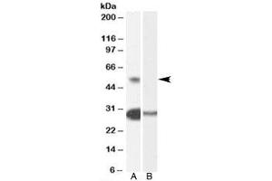 Western blot testing of human testis lysate with TCFL5 antibody at 0. (TCFL5 抗体)