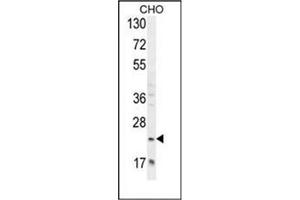 Western blot analysis of RILPL2 Antibody (Center) in CHO cell line lysates (35ug/lane).