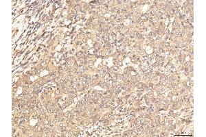 IHC analysis of BHMT using anti-BHMT antibody (ABIN7599940). (BHMT 抗体  (AA 13-386))