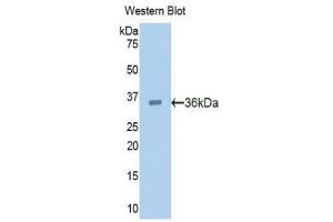 Western Blotting (WB) image for anti-Proprotein Convertase Subtilisin/kexin Type 9 (PCSK9) (AA 156-461) antibody (ABIN1860147)