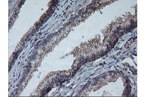 Image no. 3 for anti-Archain 1 (ARCN1) antibody (ABIN1497571) (ARCN1 抗体)