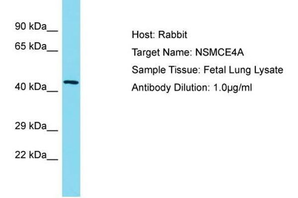 NSMCE4A 抗体  (C-Term)