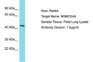 Host: Rabbit Target Name: NSMCE4A Sample Type: Fetal Lung lysates Antibody Dilution: 1.