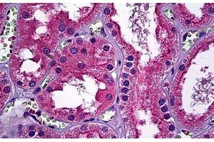 Human Kidney, Tubules: Formalin-Fixed, Paraffin-Embedded (FFPE) (ERBB3 抗体  (AA 21-332))