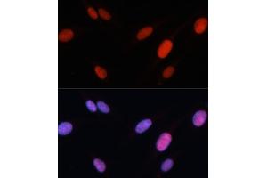 Immunofluorescence analysis of U-2 OS cells using FOSL2 antibody (ABIN3016548, ABIN3016549, ABIN3016550 and ABIN6219779) at dilution of 1:100. (FOSL2 抗体  (AA 187-326))
