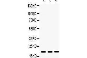 Western Blotting (WB) image for anti-gamma-Interferon-Induced Monokine (CXCL9) (AA 23-125) antibody (ABIN3042781) (CXCL9 抗体  (AA 23-125))