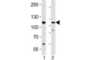 Western blot analysis of lysate from 1) human LNCaP cell line and 2) mouse lung tissue using PRDM16 antibody at 1:1000.