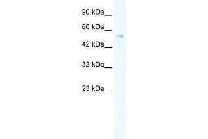 WB Suggested Anti-ZNF613 Antibody Titration:  0. (ZNF613 抗体  (C-Term))
