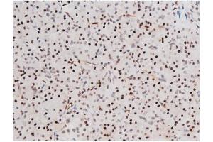 Immunohistochemistry (IHC) image for anti-Forkhead Box O4 (FOXO4) (pThr451) antibody (ABIN6256565)