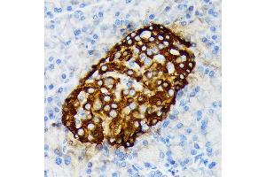 Immunohistochemistry of paraffin-embedded rat pancreatic islet using Chromogranin A Rabbit mAb (ABIN7266366) at dilution of 1:100 (40x lens). (Chromogranin A 抗体)