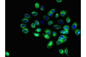 Immunofluorescent analysis of A549 cells using ABIN7171373 at dilution of 1:100 and Alexa Fluor 488-congugated AffiniPure Goat Anti-Rabbit IgG(H+L) (CD1c 抗体  (AA 18-302))