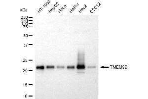 Western blotting analysis using TMEM9B antibody (ABIN7800560). (Recombinant TMEM9B 抗体)
