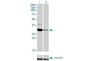 Western blot analysis of ZNF215 over-expressed 293 cell line, cotransfected with ZNF215 Validated Chimera RNAi (Lane 2) or non-transfected control (Lane 1). (ZNF215 抗体  (AA 1-304))