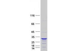 Validation with Western Blot