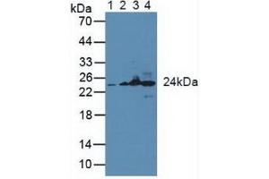 Figure. (GSTK1 抗体  (AA 19-222))