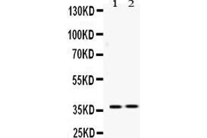 Western blot analysis of HDGF expression in rat liver extract ( Lane 1) and 22RV1 whole cell lysates ( Lane 2). (HDGF 抗体  (C-Term))