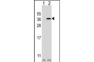 Western blot analysis of SPDYA (arrow) using rabbit polyclonal SPDYA Antibody (Center) (ABIN6244012 and ABIN6579062). (SPDYA 抗体  (AA 147-175))