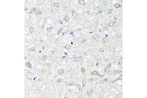 Immunohistochemistry of paraffin-embedded rat brain using IL33 antibody at dilution of 1:100 (x40 lens). (IL-33 抗体)