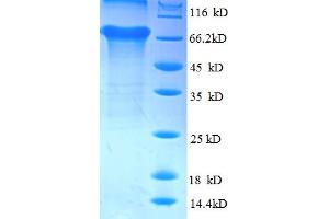 SDS-PAGE (SDS) image for TAR DNA Binding Protein (TARDBP) (AA 1-396), (partial) protein (GST tag) (ABIN5710454) (TARDBP Protein (AA 1-396, partial) (GST tag))