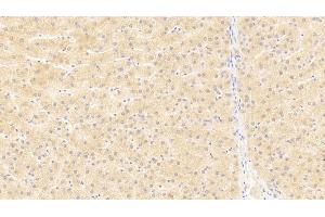 Detection of Flt3L in Human Liver Tissue using Monoclonal Antibody to FMS Like Tyrosine Kinase 3 Ligand (Flt3L) (FLT3LG 抗体  (AA 83-182))