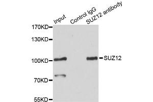 Immunoprecipitation analysis of 200ug extracts of HeLa cells using 3ug SUZ12 antibody. (SUZ12 抗体)