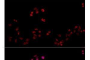 Immunofluorescence analysis of HeLa cells using PCNA Polyclonal Antibody at dilution of 1:100. (PCNA 抗体)